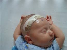 Henry Bartkowski Obituary (2011)