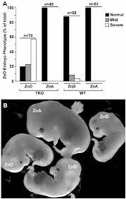 Effects Of Dietary Zinc Deficiency During Pregnancy On Embryonic Growth Download Scientific Diagram