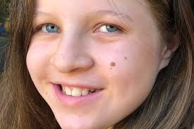 Fundraiser by Rachel Gordon : Help Paola Conquer Severe Neuromuscular  Scoliosis