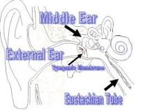 Image result for icd 10 code for acute suppurative otitis media