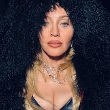 Madonna Plastic Surgery