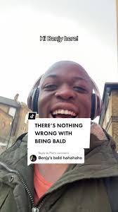 Embracing Baldness: A Journey of Self-Acceptance