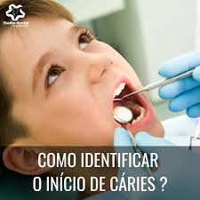 COMO IDENTIFICAR O INÍCIO DE CÁRIES? O processo da cárie é geralmente  crônico (lento) e o início é marcado pelo aparecimento de uma mancha branca  na superfície do esmalte que ao progredir