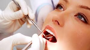 Diş taşı temizleme evde bulunabilecek basit malzemelerle yapılabilir, fakat kontrolsüz kullanımlarda dişlerde zararlara neden olacaktır. Dis Tasi Temizleme Nasil Olur Dis Tasi Nedir Saglik Haberleri