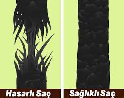 Saclarin Saglamlik Testi Saglik Paylasimlari Sac Saglikli Sac Saglik