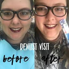 Gluten in dental polish not a concern