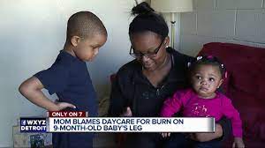 Mother Angry After She Wasn T Told Her Baby Was Burned At Detroit Daycare Youtube