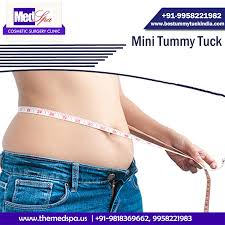 Pin On Tummy Tuck Abdominoplasty