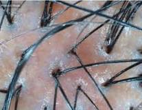 Image result