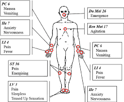 Acupuncture Points Hand Out The Figure Illustrates The