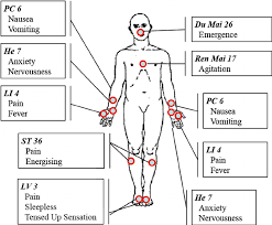 acupuncture points hand out the figure illustrates the