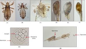Image result for Lice