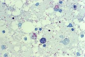 Image result for Rickettsiae