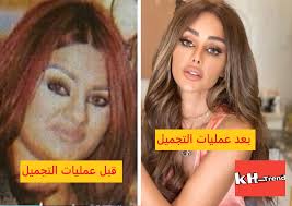 هل هناك أراء سلبية حول الطبيب وإجراءه للعمليات الجراحية. Ø§Ù‰ Ø´Ù‰ Ù…Ø¤Ù‚Øª Ø³Ù‡Ù„ Ø§Ù„ÙÙ‡Ù… Ø¹Ù‡ÙˆØ¯ Ø§Ù„Ø¹Ù†Ø²ÙŠ ÙˆØ®ÙˆØ§ØªÙ‡Ø§ Timmernabben Org