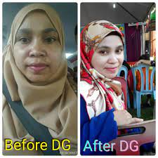 Diamond gold skincare, produk yg sangat sesuai utk semua kulit. Review Diamond Gold Skincare