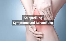 Knieprellung Symptome Behandlung Dauer Praktischarzt