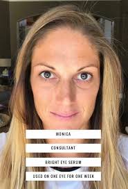 Carrie Doss- Rodan+Fields Independent Consultant