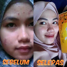 Siapa jer yang patut pakai deeja cosmetic? 3 Sebab Utama Untuk Memilih Deeja Cosmetics Sebagai Produk Penjagaan Kulit Korang Farah Dafri