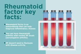 what is the rheumatoid factor blood test