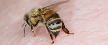 Apis mellifera)، بالإضافة إلى ثمانية أنواع أخرى تستوطن كلّاً من آسيا، وأوروبا. ÙˆØµÙØ§Øª Ø·Ø¨ÙŠØ¹ÙŠØ© Ù„Ø¹Ù„Ø§Ø¬ Ù„Ø³Ø¹Ø§Øª Ø§Ù„Ù†Ø­Ù„ ÙˆÙŠØ¨ Ø·Ø¨