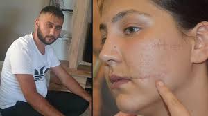 Yaraları görmek isteyince mahkeme heyeti salonu boşalttı