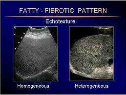 Pin By Lama A On Ultrasound Sonography Ultrasound Ultrasound Sonography