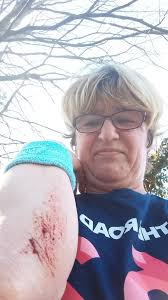 Big THANK YOU to the three runners who stopped and helped me in Clydach  after I fell this morning, nice to know us runners look out for each other  ❤️ Few cuts