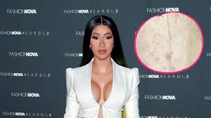 Born in manhattan and raised in the bronx, new york city. Wegen Hautproblemen Cardi B Sucht Rat Bei Ihren Followern Promiflash De