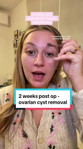 Full overview 2 weeks post op!! Sorry its so long i was trying to cover  everything 😁 #ovariancyst #ovariancystremoval #laproscopicsurgery  #cisteovaric #cystremovalsurgery