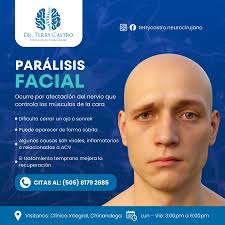 La parálisis facial ocurre cuando el nervio que controla los músculos de la  cara se afecta, dificultando cerrar un ojo, sonreír o mover adecuadamente  un lado del rostro. Puede aparecer de forma