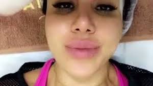 How Coach Alaa Got Glowing Skin With 7 Derma? [Celebrity Story]