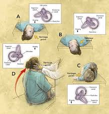 Pin By Ndbc Edina Mn On Vestibular Disorders Physical Therapy Tinnitus Symptoms Medical Conditions