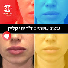 אמנות עיצוב השפתיים על פי ד"ר יוני קליין. בואי ליהנות מהשפתיים שתמיד חלמת  עליהן. Yoni Klein