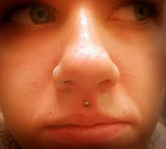 Skin Growth Over Medusa Piercing | Tiktok