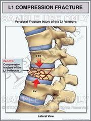 The lumbar spine is located in the lower back below the cervical and thoracic sections of the spine. Pin On Anatomy