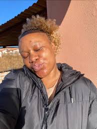 What are dark brown spots