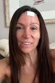 Bulldog Tears Off Vet's Nose During Exam (Exclusive)