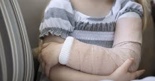 Maybe you would like to learn more about one of these? How To Tell If Your Child Broke Their Arm Riley Children S Health