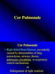 Image result for Cor Pulmonale