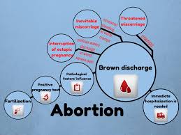 We did not find results for: Brown Discharge Week Before Period Teenage Pregnancy