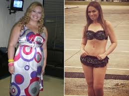 Resultado de imagem para antes e depois dos artistas brasileiros