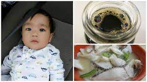 Khasiat pati ikan haruan untuk gastrik. Lebih 3 Jam Dalam Bilik Bersalin Usus Melekat Akibat Makan Pati Ikan Haruan