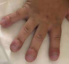 Image result for Digital Clubbing