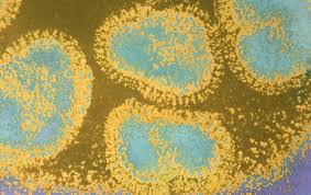 How Does The New Coronavirus Compare With The Flu Scientific American As you all know, reddit is the best source of information and. how does the new coronavirus compare