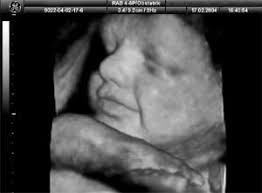 If you would like to share your before and after photos, please contact us and sen them our way. New 3d 4d Ultrasound Provides Detailed Images Of Fetuses Women S Care Obstetrics Gynecology And Midwifery Eugene Springfield