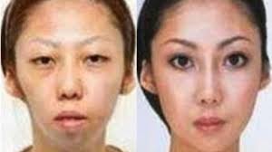 Disney Family Recipes Crafts And Activities Plastic Surgery Chinese Man Cosmetic Surgery
