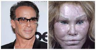 Since starting her plastic surgery odyssey, it is thought the new york socialite has undergone canthopexy, a procedure that elevates the eyes to give them a cat . Jocelyn Wildenstein Catwoman Says She Hasn T Had Plastic Surgery Rare