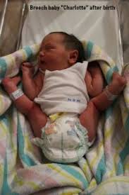 Breech Baby Understanding Your Birthing Options Nourish Breech Babies Spinning Babies Breech Birth