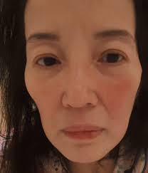 PRAYING FOR YOU, KRIS 🙏 LOOK: Kris Aquino shares an update about her  current health and condition. The TV personality says she has been  suffering with Lupus flare fever for over two