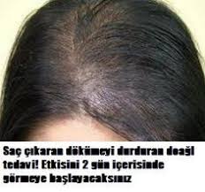 Kellige Son Sac Cikaran Dogal Kur Hair Cure Hair Loss Remedies Hair Loss Treatment